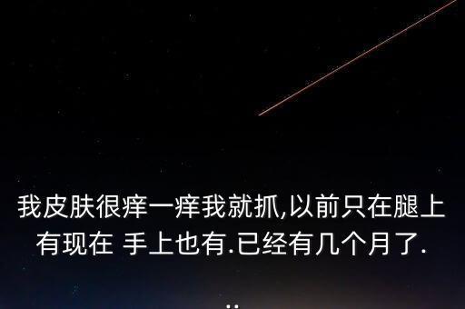 什么農(nóng)藥殘留在手上癢,手上的農(nóng)藥殘留可以用水沖掉嗎